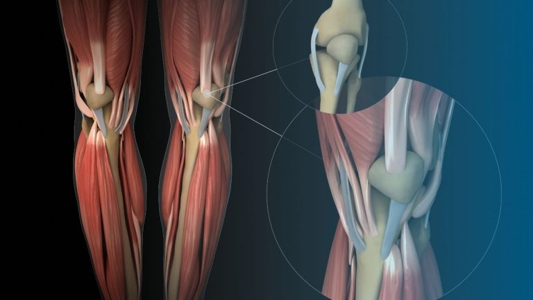Knee Muscles - How to Protect Them When Working Out